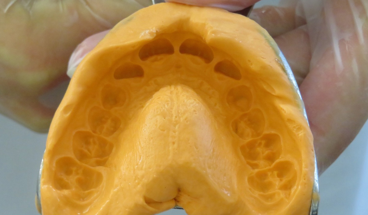 teeth straightening wax sample of adults