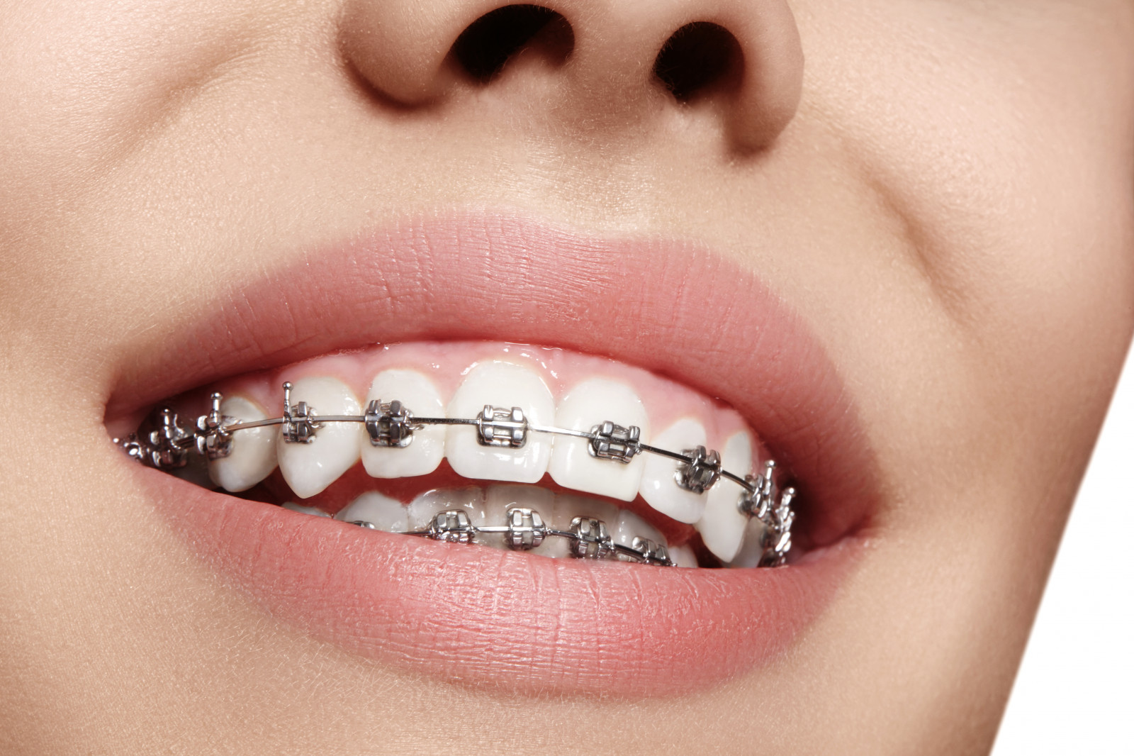 what does an orthodontist do