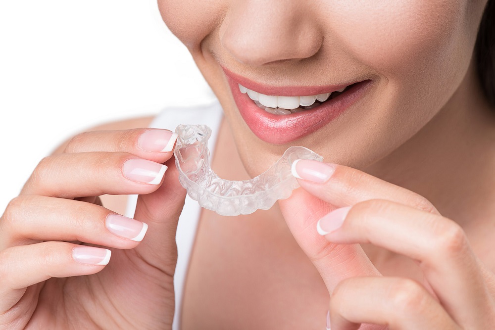 4 things you didn't know about Invisalign