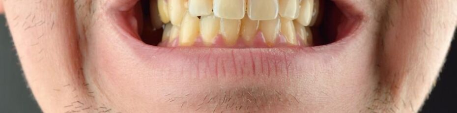 man having yellow teeth stain