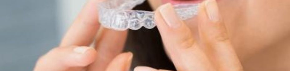 How Much Does Invisalign Cost in Calgary?