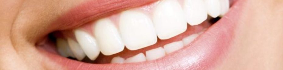 Is Teeth Whitening Safe? Debunking Common Myths