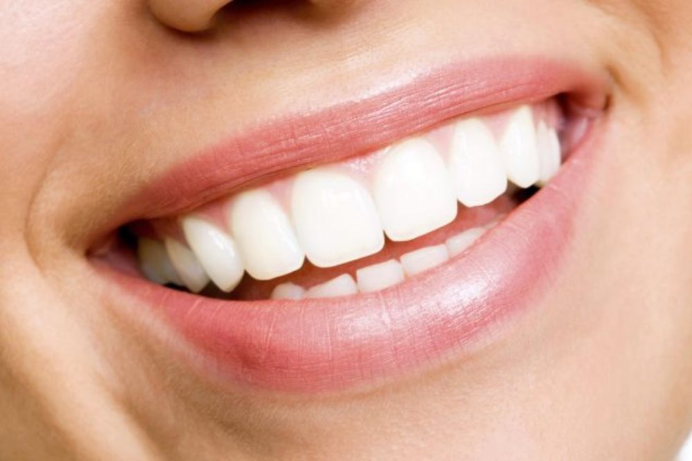 Is Teeth Whitening Safe? Debunking Common Myths
