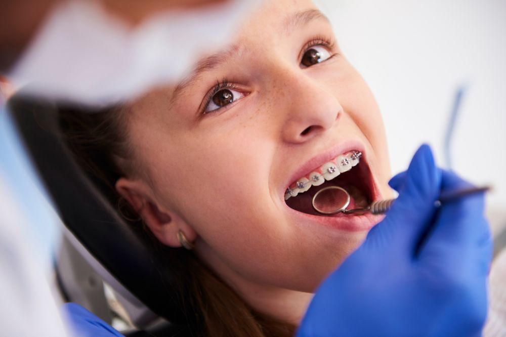 How Orthodontics Can Improve Your Oral Health and Confidence?