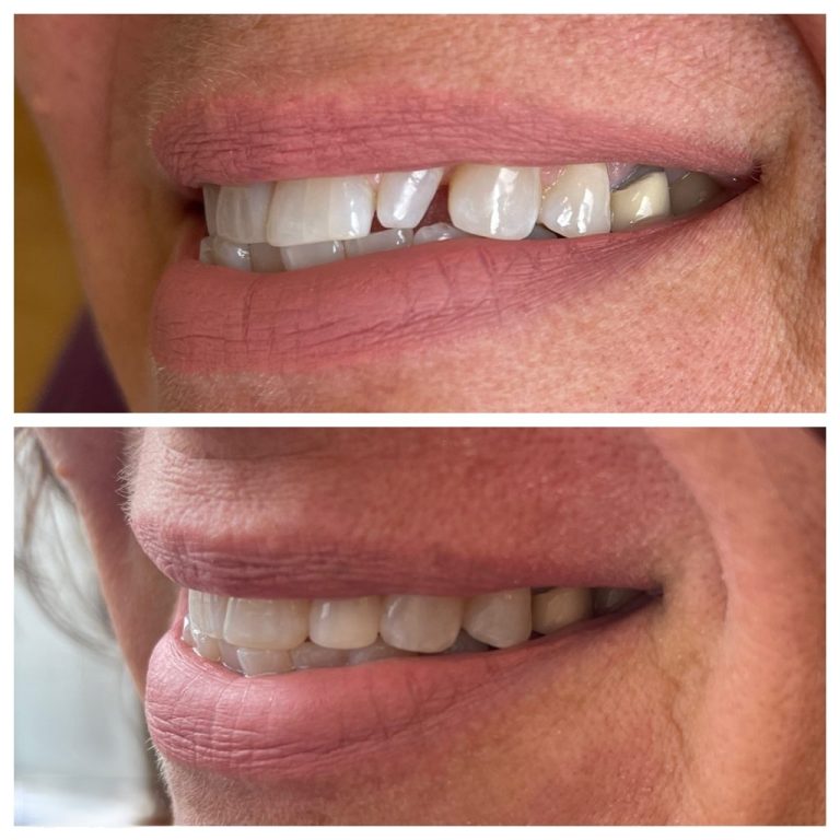 bio clear calgary nw