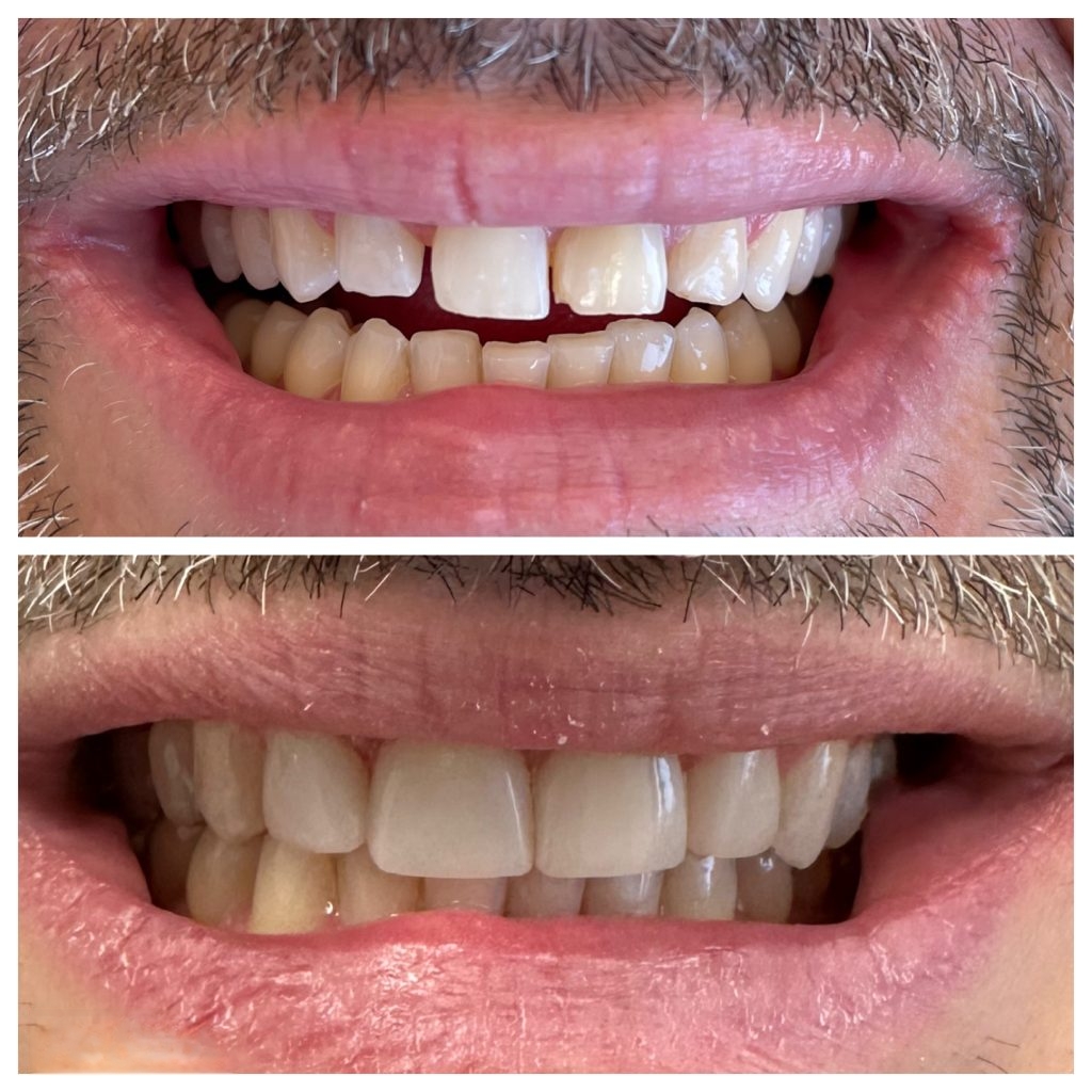 bio clear north west calgary