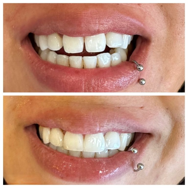 bio clear nw calgary